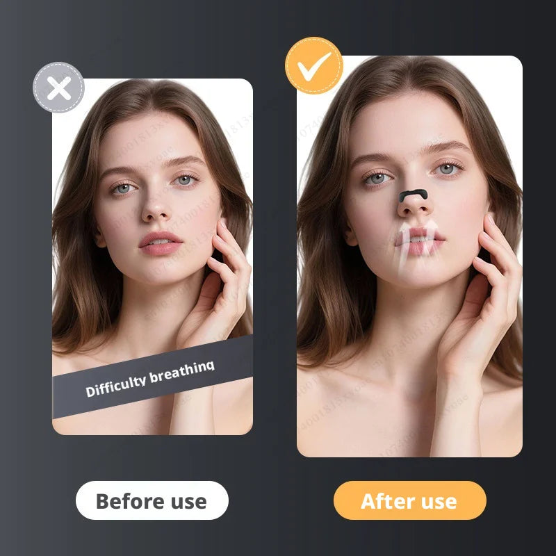 Nasal Breathing Dilator Kit